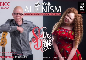 Ms and Mr Albinism Beauty Pageant and Talent Show Malawi 2019